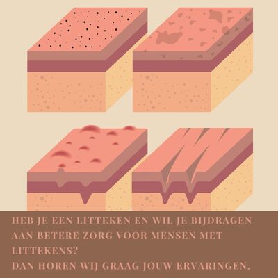 Oproep deelname enquête voor knelpuntenanalyse Littekenzorg