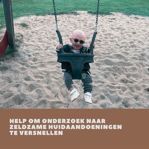 Help om onderzoek naar zeldzame huidaandoeningen te versnellen Help om onderzoek naar zeldzame huidaandoeningen te versnellen