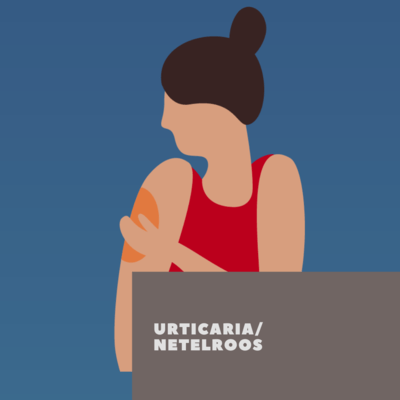 urticaria