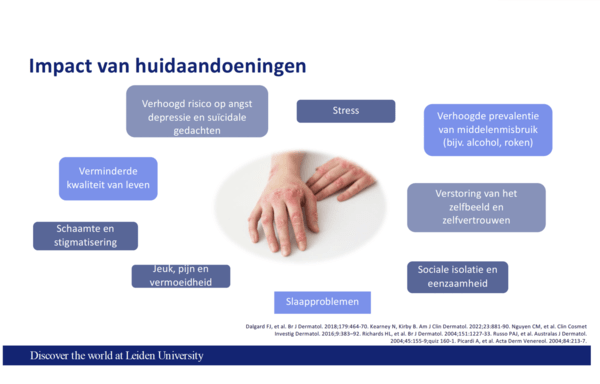 impact van huidaandoeningen